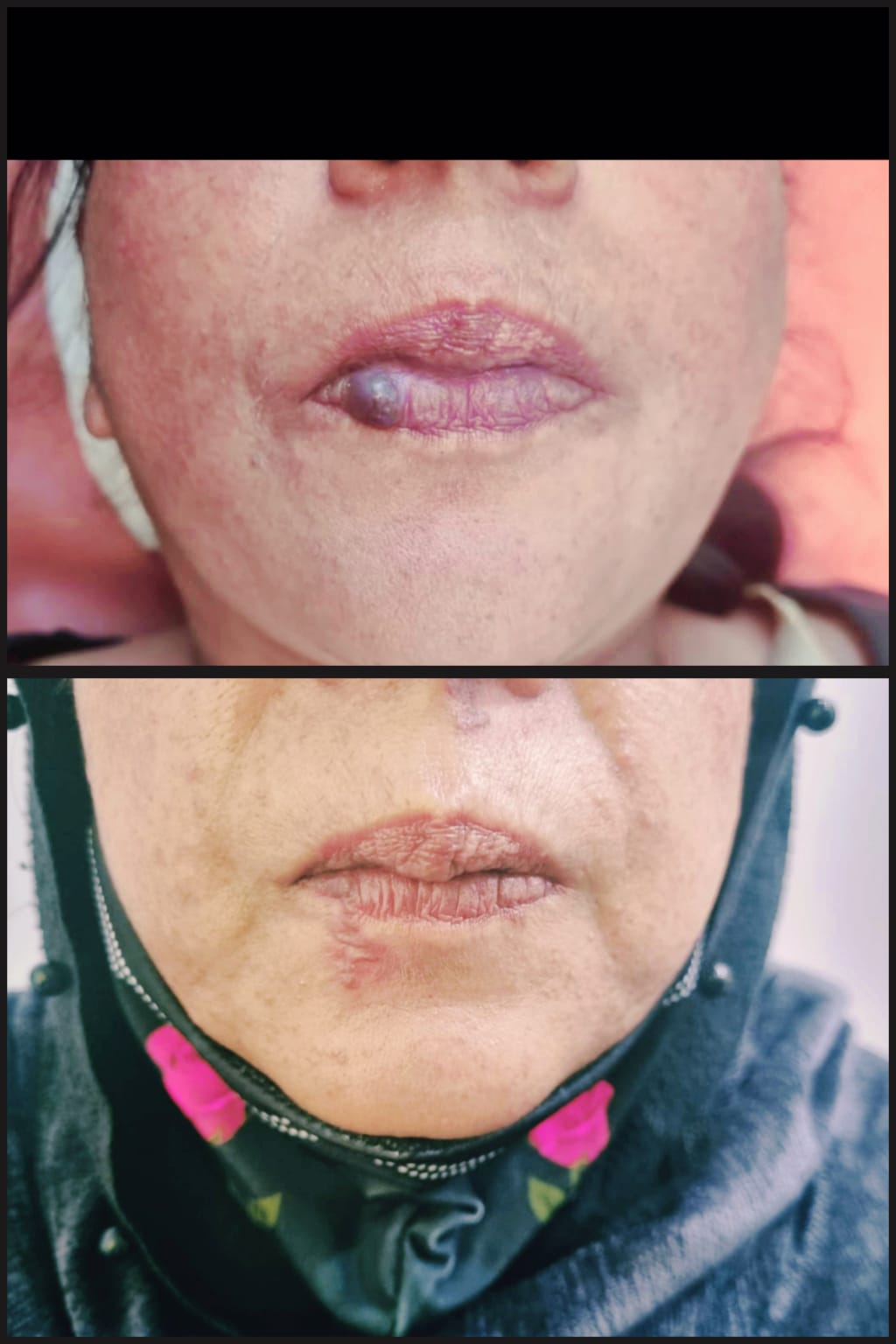 Before & After 57